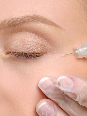 Crow's Feet Treatment with Botox Bloomfield CT